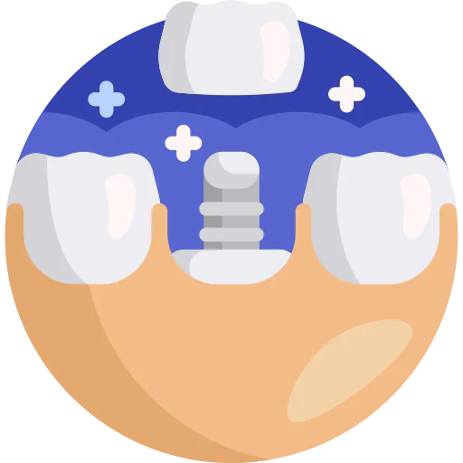 Implant icon